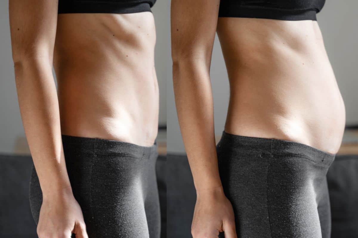 How long does diastasis recti take to improve Sheffield?