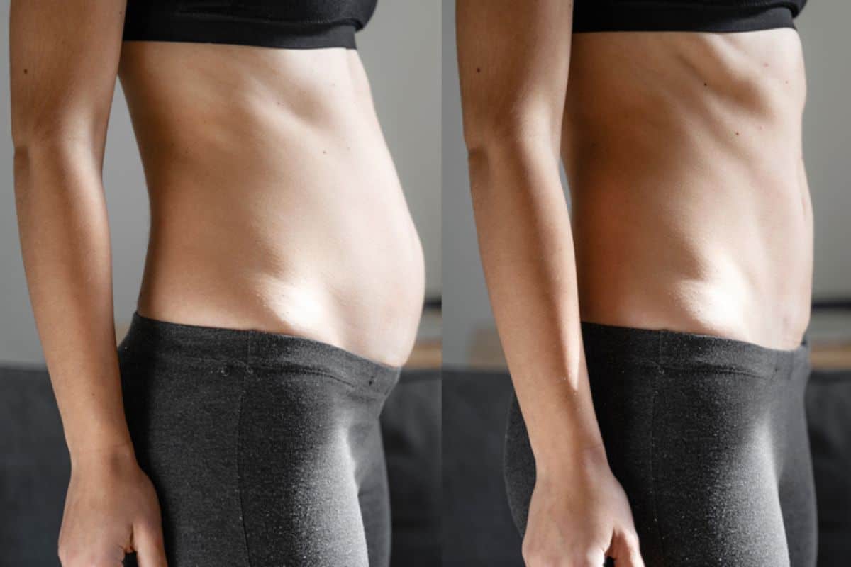Post-Pregnancy: What Happens to Your Abdominal Muscles After Birth Sheffield