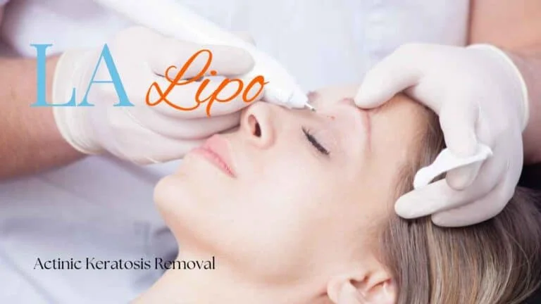 Woman receiving Actinic Keratosis Removal Treatment Sheffield