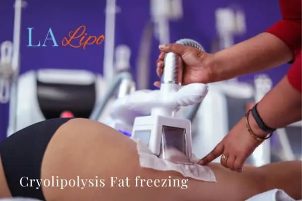 women getting fat freezing Sheffield