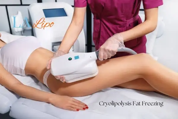 Woman receiving coolsculpting Sheffield treatment on her thighs