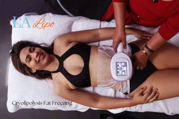 woman getting cryolipolysis Sheffield