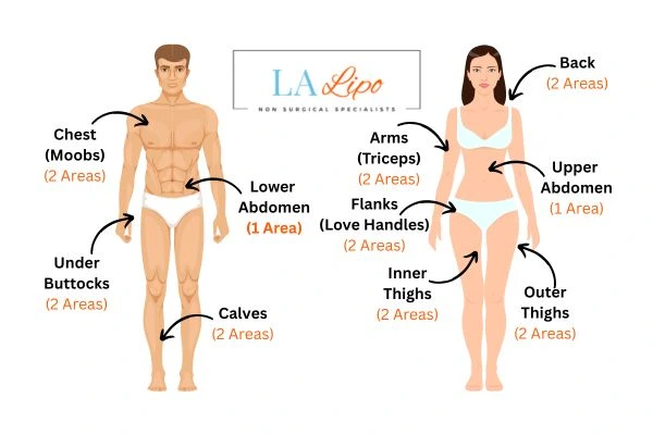 LA LIPO Cryolipolysis Areas Sheffield