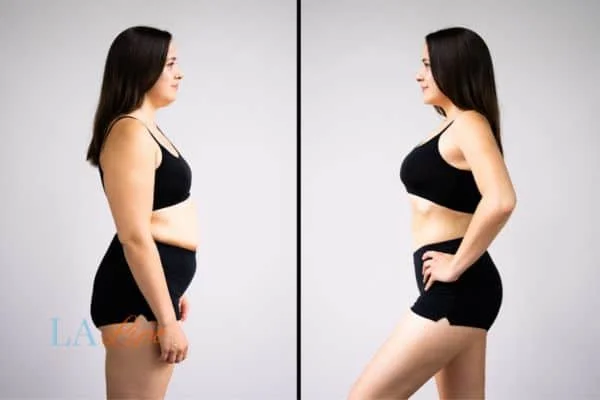 link between body image and mental health Sheffield