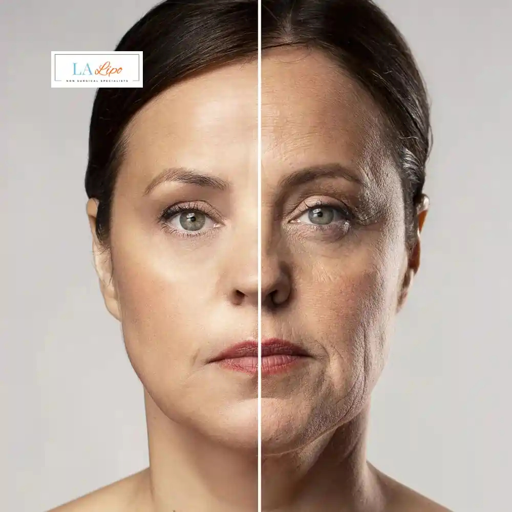 How Can You Tell If Non-Surgical Skin Tightening Is Right for You Sheffield?