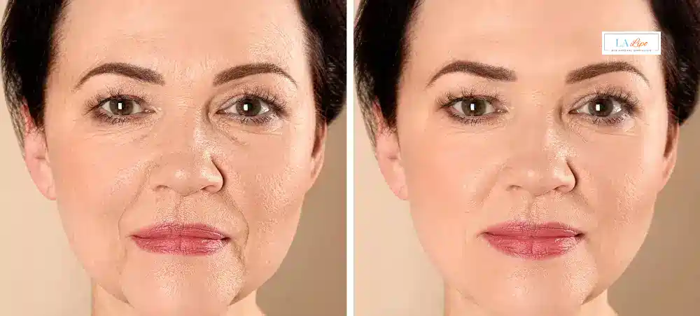 How Long Does It Take to See Results and How Long Do They Last Sheffield?