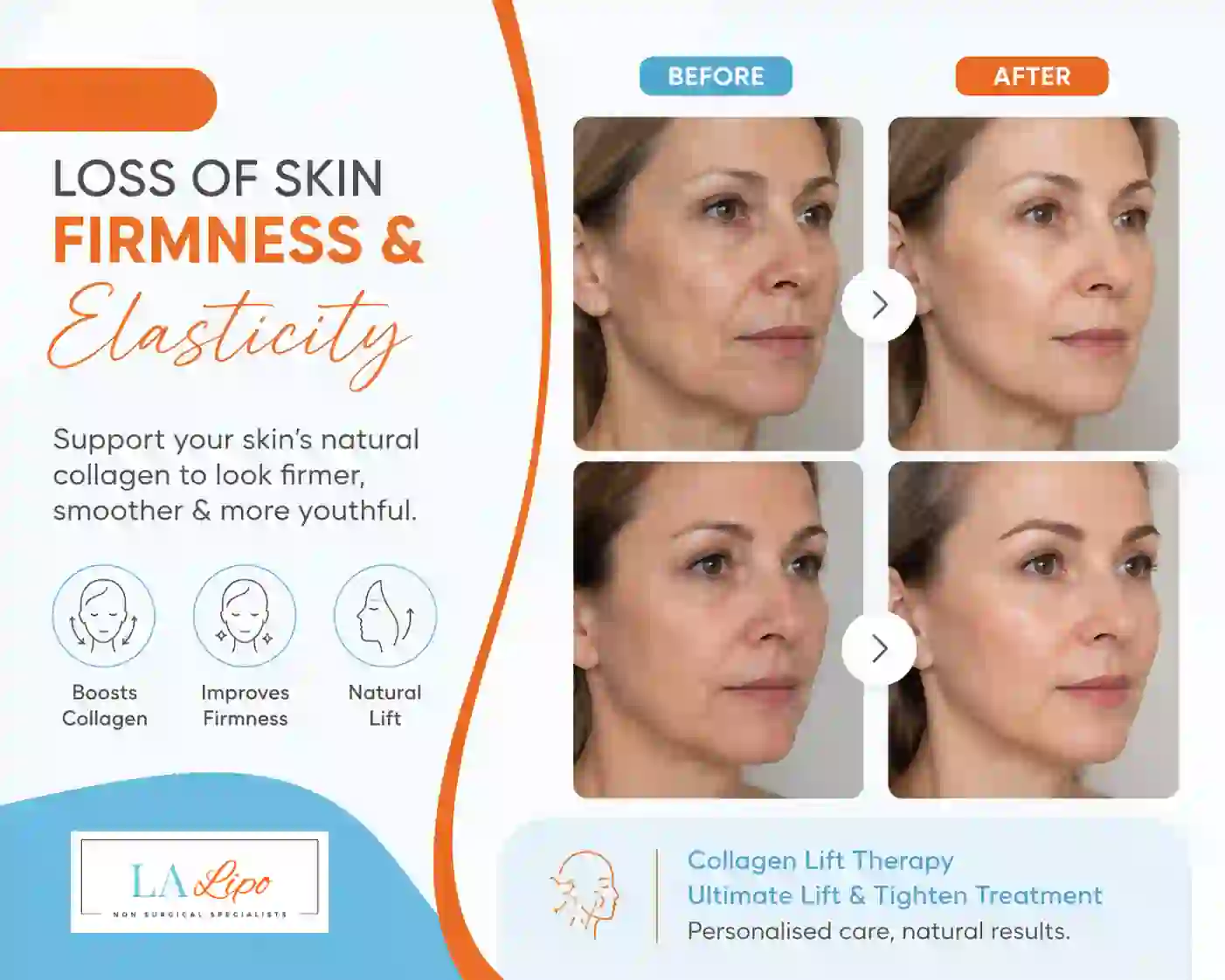 Sign #7: Loss of Skin Firmness and Elasticity Sheffield